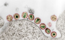 HIV-1 - Human immunodeficiency virus 1 (Retroviren) Reife Virionen (rote Hülle) sammeln sich an der Oberfläche eines T-Lymphozyten(Wirtszelle). Transmissions-Elektronenmikroskopie, Ultradünnschnitt. Quelle: © H.R. Gelderblom/RKI