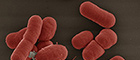 Bildausschnitt: Acinetobacter baumannii. Rasterelektronenmikroskopie. Quelle: © Gudrun Holland; Kolorierung: Michael Laue/RKI