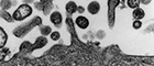 Bildausschnitt: Lymphocytic choriomeningitis virus (Arenaviren). Transmissions-Elektronenmikroskopie, Ultradünnschnitt. Maßstab = 200 nm. Quelle: © RKI