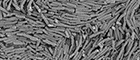 Bildausschnitt: Bacillus cereus, Kolonie, vegetative Bakterien (vorwiegend in Ketten). Raster-Elektronenmikroskopie. Maßstab = 5 μm. Quelle: © RKI