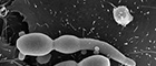 Bildausschnitt: Candida albicans auf der Oberfläche von Endothelzellen. Raster-Elektronenmikroskopie. Maßstab = 2 µm. Quelle: © Muhsin Özel, Gudrun Holland/RKI