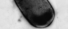 Bildausschnitt: Clostridium perfringens, einzelnes Bakterium. Transmissions-Elektronenmikroskopie, Negativkontrastierung. Maßstab = 500 nm. Quelle: © RKI