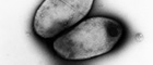 Bildausschnitt: Corynebacterium diphtheriae gravis mit Polkörperchen. Transmissions-Elektronenmikroskopie, Negativkontrastierung. Maßstab = 500 nm. Quelle: © Hans R. Gelderblom/RKI