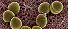 Bildausschnitt: Elektronenmikroskopische Aufnahme von Enterococcus faecalis OG1RF34. Bakterien auf Agar. Raster-Elektronenmikroskopie. Aufnahme: Gudrun Holland/RKI. Kolorierung: Tim Bergner/RKI