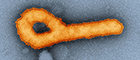 Bildausschnitt: Elektronenmikroskopische Aufnahme von Ebolaviren (Orange eingefärbt). Quelle: © Tobias Hoffmann, Andreas Kurth (2019)/RKI