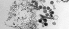 Bildausschnitt: West Nile virus.  Gattung  Flavivirus. Transmissions-Elektronenmikroskopie, Ultradünnschnitt. Balken = 100 nm. Quelle: © Hans R. Gelderblom (2003)/RKI