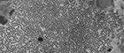 Bildausschnitt: Human papillomavirus, HPV. Biopsie Warze. Transmissions-Elektronenmikroskopie, TEM; Viren; DNA-Viren; Papillomaviridae ; Human Papillomavirus. Ultradünnschnitt. Maßstab = 1µm. Quelle: © Hans R. Gelderblom (1981)/RKI