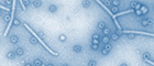 Hepatitis B Virus, HBV, Primärvergrößerung x 50000, gentechnisch erzeugte HBV-Cores; koloriert. Quelle: © Muhsin Özel/RKI