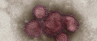 Bildausschnitt: Influenza A virus A/California/7/2009 (H1N1), koloriert, Negativkontrastierung im Transmissionselektronenmikroskop (TEM) Primärvergrößerung x 85000. Quelle: © Gudrun Holland, N. Bannert/RKI