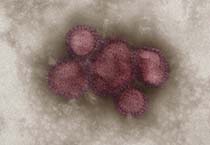 Elektronenmikroskopische Aufnahme von Influenzaviren, koloriert. Quelle: RKI