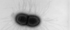 Bildausschnitt: Klebsiella pneumoniae. Transmissions-Elektronenmikroskopie, Negativkontrastierung. Maßstab = 1 µm. Quelle: © Hans R. Gelderblom, Andrea Männel, Rolf Reissbrodt/RKI
