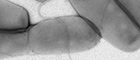 Bildausschnitt: Legionella pneumophila, Stamm Corby. Transmissions-Elektronenmikroskopie, Negativkontrastierung. Maßstab = 500 nm. Quelle: © Norbert Bannert, Gudrun Holland/RKI