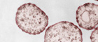 Bildausschnitt: Masernvirus (Paramyxoviren). Transmissions-Elektronenmikroskopie, Ultradünnschnitt. Maßstab = 200 nm. Quelle: © Hans R. Gelderblom, Freya Kaulbars. Kolorierung: Andrea Schnartendorff/RKI