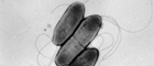 Bildausschnitt: Burkholderia pseudomallei, begeißelte Bakterien. Transmissions-Elektronenmikroskopie, Negativkontrastierung. Maßstab = 1 μm. Quelle: © RKI