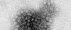 Bildausschnitt: Aggregat von Partikeln des Norovirus in einer Stuhlprobe des Menschen. Gasteroenteritis-Ausbruch. Transmissions-Elektronenmikroskopie, Negativkontrastierung. Maßstab = 100 nm. Quelle: © Michael Laue/RKI