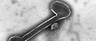 Bildausschnitt: Paramyxovirus aus Zellkulturüberstand, Transmissions-Elektronenmikroskopie, Negativkontrastierung. Quelle: © Hans R. Gelderblom/RKI