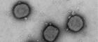 Bildausschnitt: Vaccinia virus (Orthopockenviren), Impfstamm gegen die Pocken. Transmissions-Elektronenmikroskopie, Negativkontrastierung. Maßstab = 200 nm. Quelle: © RKI