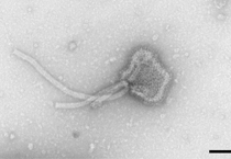 HRSV, Human respiratory syncytial virus. Transmission electron microscopy, negative staining; negative staining; Negativ-Kontrastierung; Elektronenmikroskopie; TEM; Viren; Paramyxoviridae; Pneumovirus. Bar = 200 nm. Quelle: © Hans R. Gelderblom (2001)/RKI