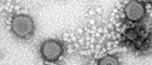 Bildausschnitt: Rift Valley fever virus MP12 (RVFV; Bunyavirus). Transmissions-Elektronenmikroskopie, Negativkontrastierung. Maßstab = 100 nm. Quelle:© RKI