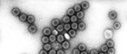Bildausschnitt: Humanes Rotavirus (Rotaviren). Transmissions-Elektronenmikroskopie, Negativkontrastierung. Maßstab = 100 nm. Quelle: © Hans R. Gelderblom/RKI