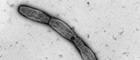 Bildausschnitt: Burkholderia mallei, unbegeißelte Bakterien (kettenbildend). Transmissions-Elektronenmikroskopie, Negativkontrastierung. Maßstab = 1 μm. Quelle: © RKI