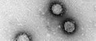 Bildausschnitt: SARS-Coronavirus (Coronaviren). Transmissions-Elektronenmikroskopie, Negativkontrastierung. Maßstab = 100 nm. Quelle: © RKI