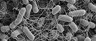 Bildausschnitt: Salmonella enterica Subspecies enterica Serovar Typhimurium (Salmonellen), Bakterienkolonie. Raster-Elektronenmikroskopie. Maßstab = 1 μm. Quelle: © RKI