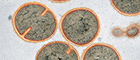 Bildausschnitt: Staphylococcus aureus. Ultradünnschnitt im Transmissions-Elektronenmikroskop (TEM). Primärvergrößerung x 68 000. Quelle: © RKI