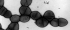 Bildausschnitt: Streptococcus pneumoniae (Pneumokokken). Transmissions-Elektronenmikroskopie, Negativkontrastierung. Maßstab = 1 µm. Quelle: © Hans R. Gelderblom, Rolf Reissbrodt/RKI