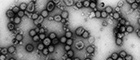Bildausschnitt: Semliki Forest virus (Alphaviren). Transmissions-Elektronenmikroskopie, Negativkontrastierung. Maßstab = 200 nm. Quelle: © RKI