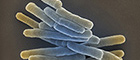 Bildausschnitt: Mycobacterium tuberculosis. Scanning electron microscopy. Bar = 1 µm. Quelle: © Gudrun Holland 2013/RKI
