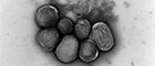 Bildausschnitt: Francisella tularensis, Bakteriengruppe. Transmissions-Elektronenmikroskopie, Negativkontrastierung. Maßstab = 1 μm. Quelle: © RKI