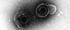 Varicella-zoster virus, Human Herpes Virus-3, HHV-3, Vergrößerung 160000-fach. Quelle: © Hans R. Gelderblom (2006)/RKI