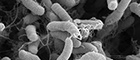 Bildausschnitt: Vibrio cholerae. Raster-Elektronenmikroskopie. Maßstab = 1 µm. Quelle: © Muhsin Özel, Gudrun Holland/RKI